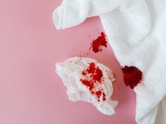 Problemas del sangrado menstrual abundante Sangrado menstrual abundante