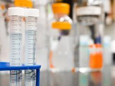 Estudio clínico sobre candidiasis vulvovaginal en Clínica Palacios candidiasis clínico