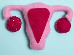 ¿Qué es el síndrome de ovario poliquístico? síndrome de ovario poliquístico